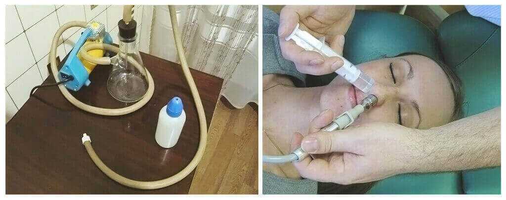 Кукушка - описание услуги, при каких болезнях и какие врачи назначают