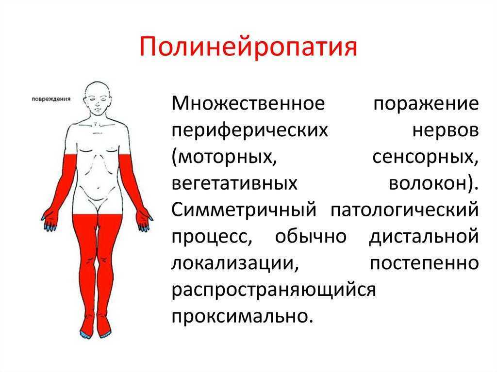 Полинейропатия при экзогенных интоксикациях. идиопатическая полинейропатия. диагностика и лечение