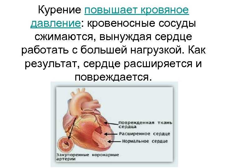 Высокое давление: что делать при артериальной гипертензии