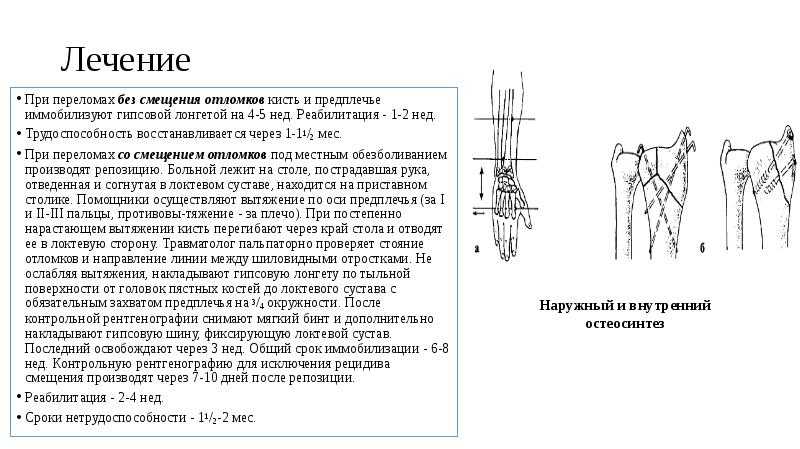 Перелом шиловидного отростка локтевой кости сроки лечения