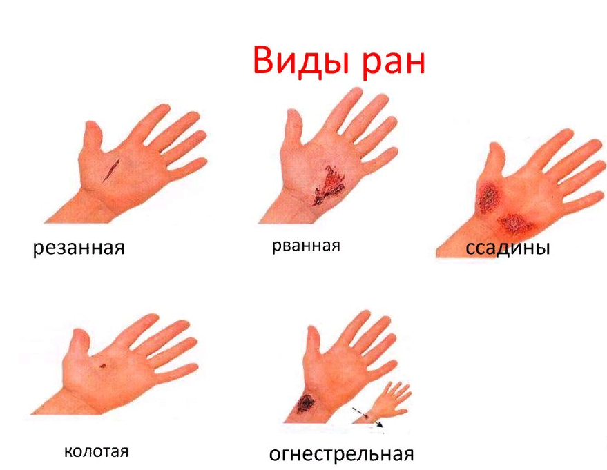 Морфологические особенности некоторых телесных повреждений (принципы описания)
