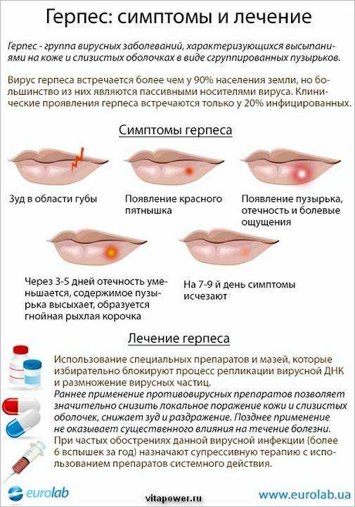 Герпес на губе  и другие типы герпетической инфекции