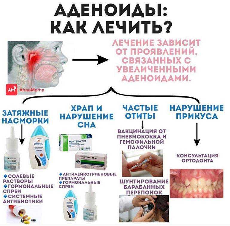 Симптомы и лечение: аденоидит . лор-клиника "солнце"