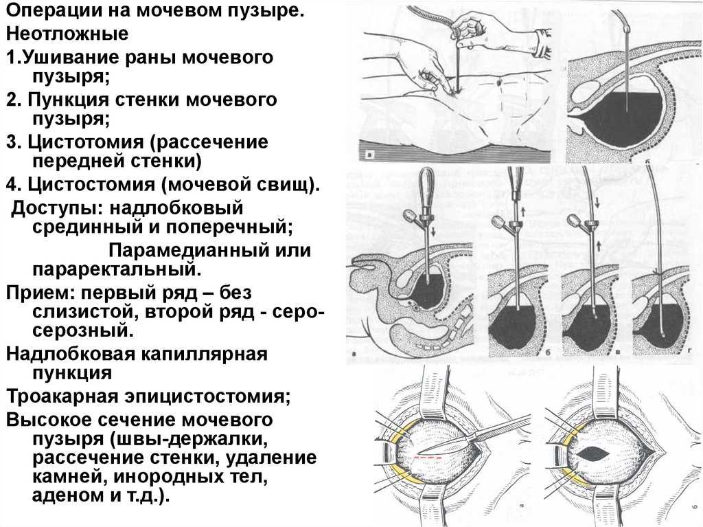 Боль при мочеиспускании после родов: основные проблемы, лечение и профилактика