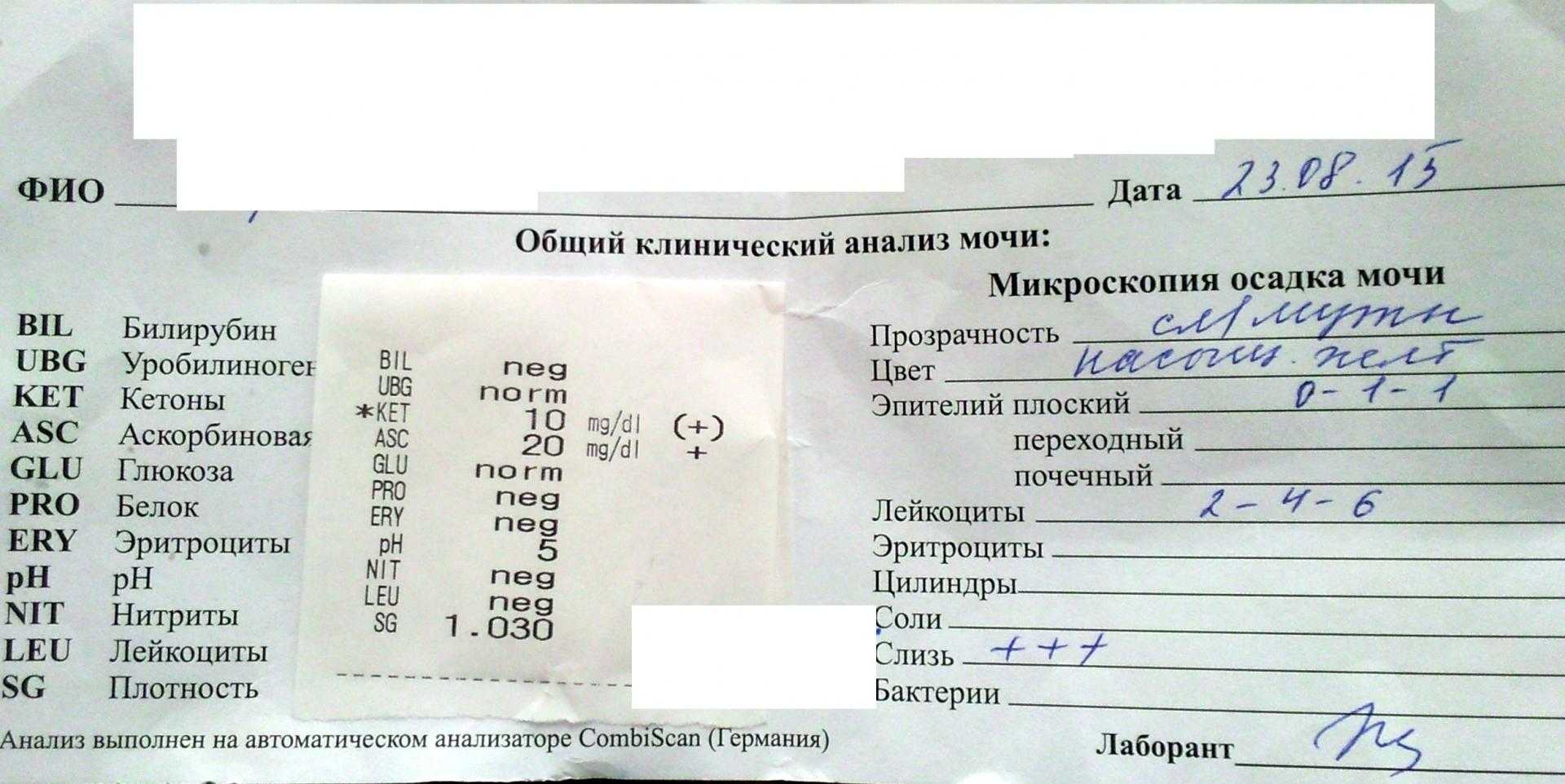 Общий анализ мочи: как собирать, сдавать, правильно подготовиться