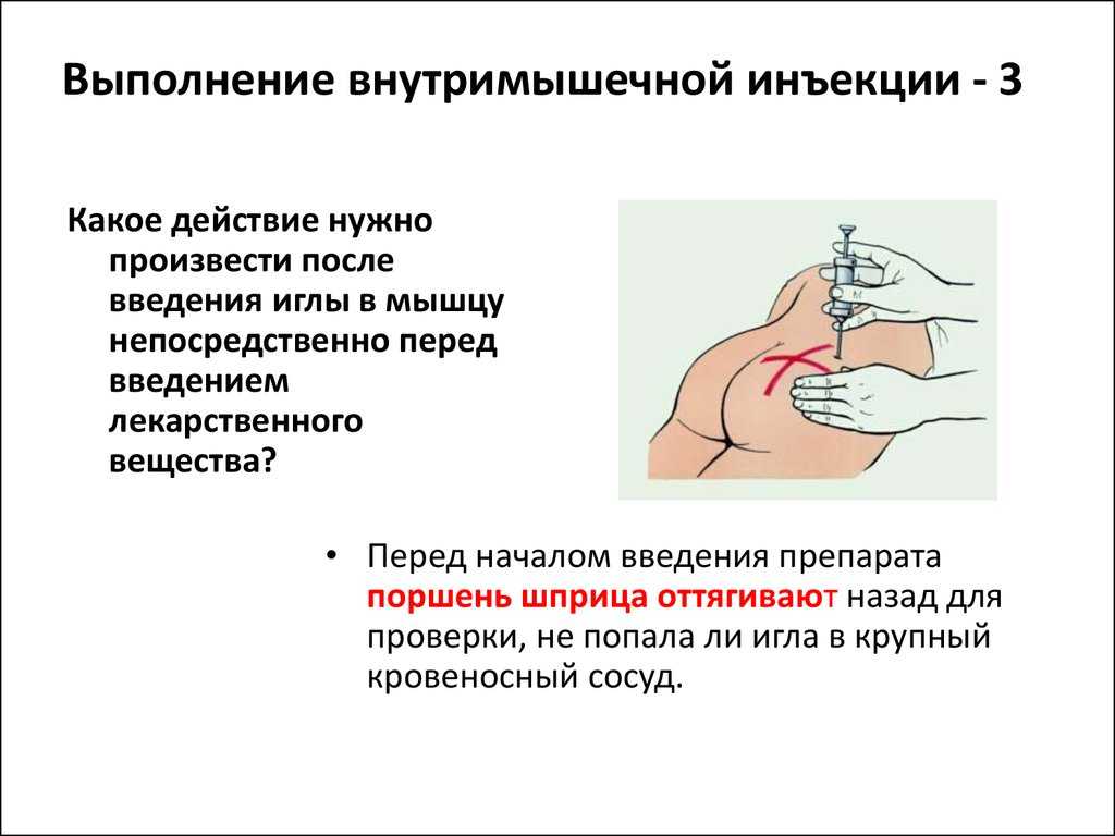 Подкожная инъекция, техника, места вкола