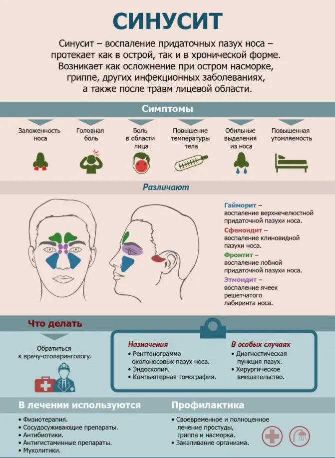 Лечение острого гнойного гайморита у взрослых