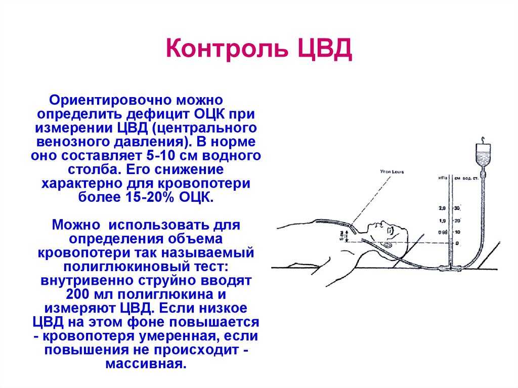 Венозное давление и его значение для организма