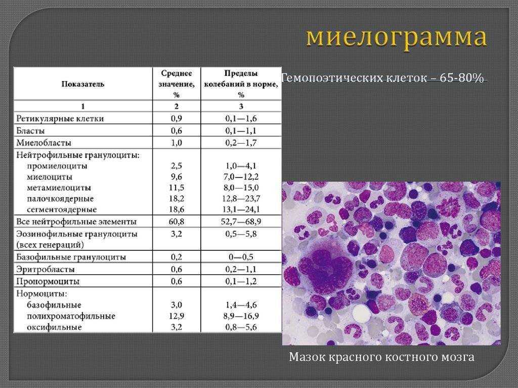 В крови плазматические клетки: что это значит, причины, как лечить