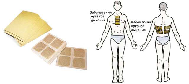 Перцовый пластырь от кашля: инструкция по применению, отличие от горчичного по действию, противопоказания к использованию, как клеить