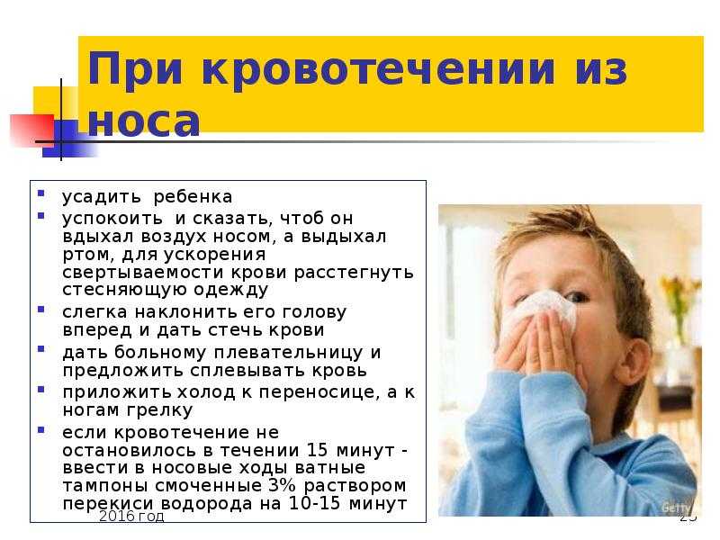 Кровь из носа у ребенка – тревожный симптом?