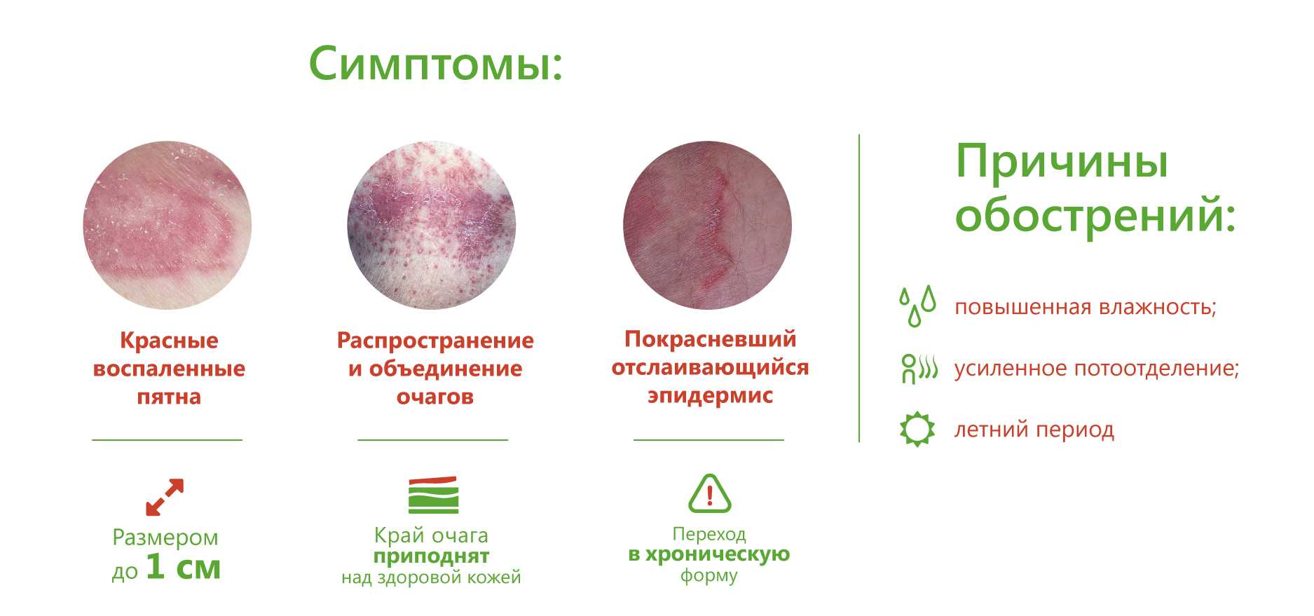 Лучевой дерматит - описание болезни, симптомы | 📝 диагностика и 👩‍⚕️ лечение - лучевой дерматит