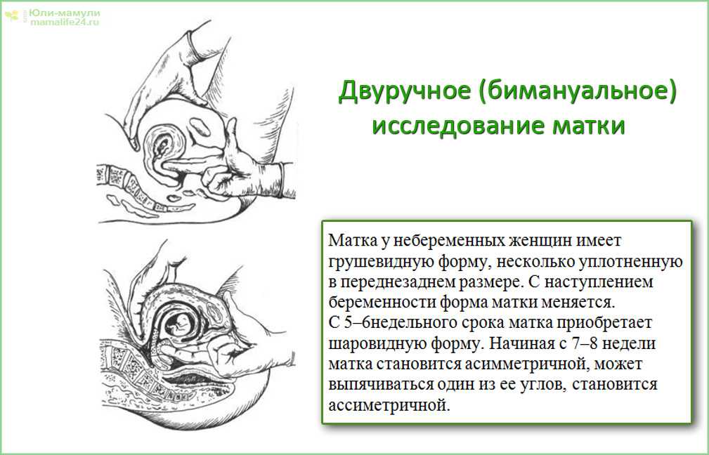 Определение беременности акушером-гинекологом  Может ли гинеколог при осмотре на ранних сроках диагностировать беременность  Сегодня для сомнений у женщин