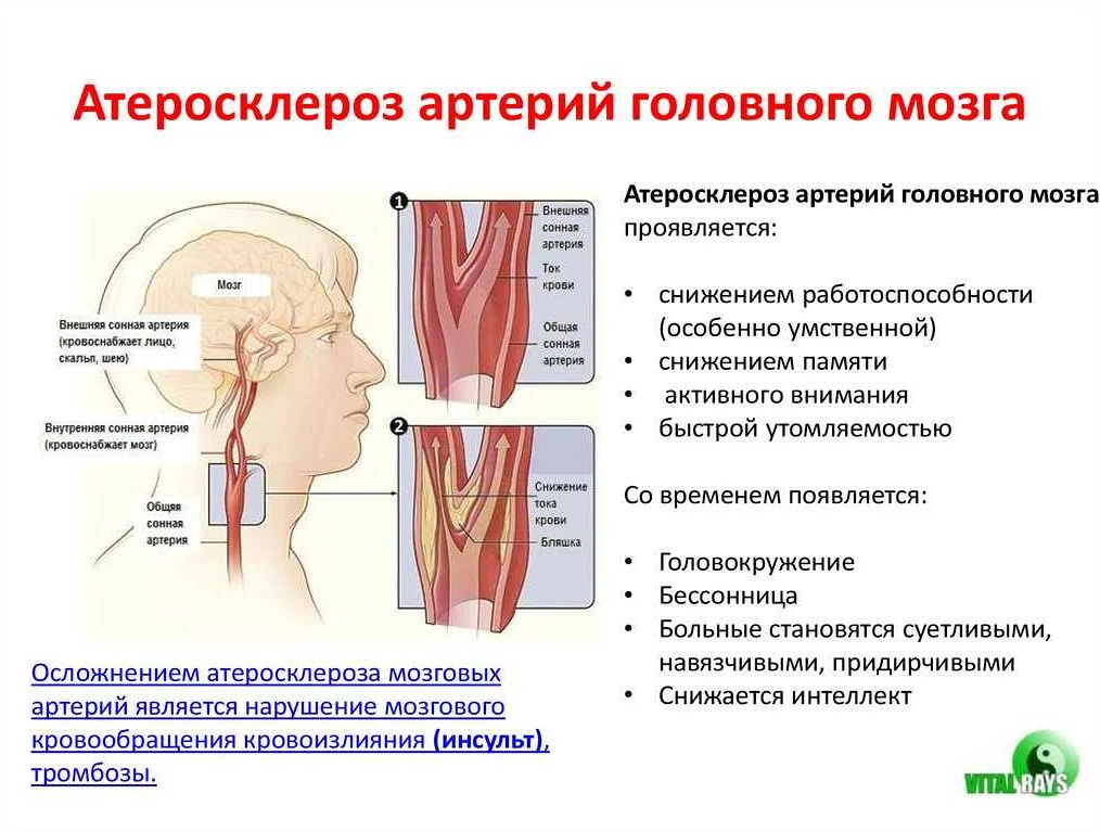 Уздг брахиоцефальных сосудов: подготовка, как делают, что показывает исследование