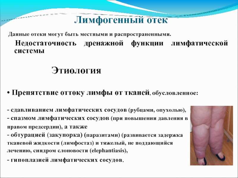 Лечение лимфедемы ног народными средствами