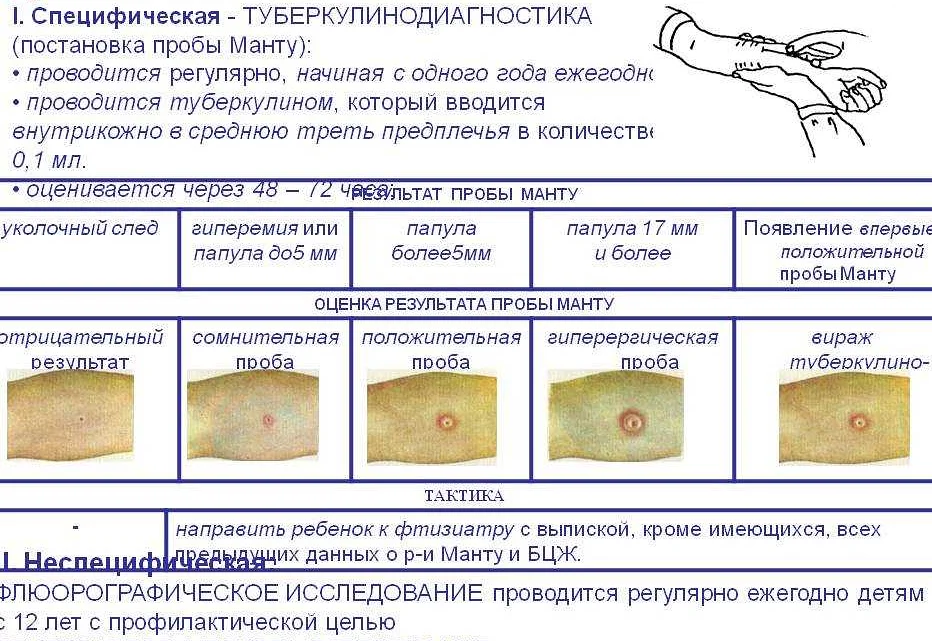 Реакция на пробу манту: норма у детей и взрослых