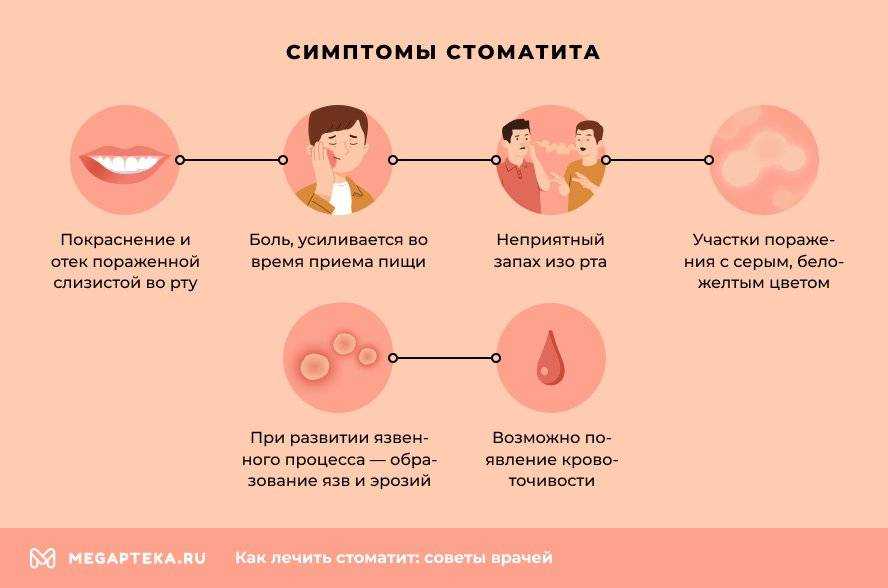 Герпес в полости рта: причины, симптомы и лечение болезни  Вирус гepпeса в полости рта  Многим знакомы болезненные пузырьки на губах, но границы проявления