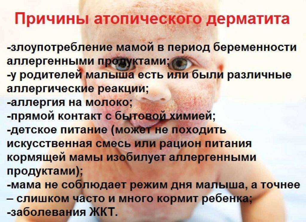 Симптомы и способы лечения аллергического дерматита у детей