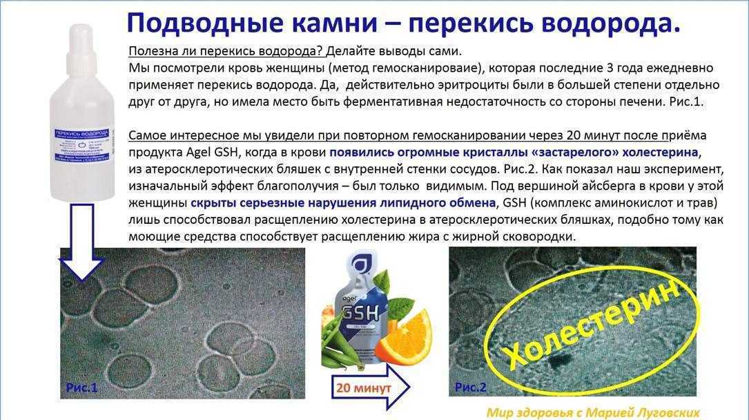 Во рту ожог от перекиси водорода что делать