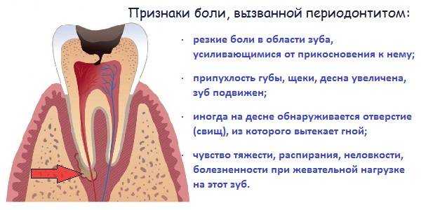 Боль после удаления зуба