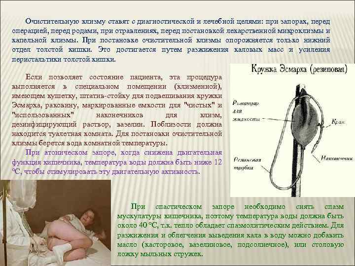 Очистительные и лекарственные клизмы — правила постановки
