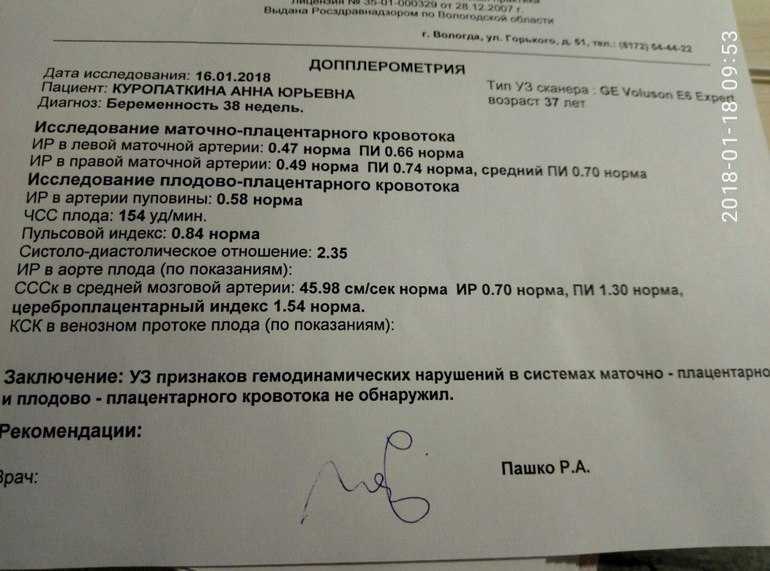 Допплерометрия: суть метода, проведение, показатели и интерпретация