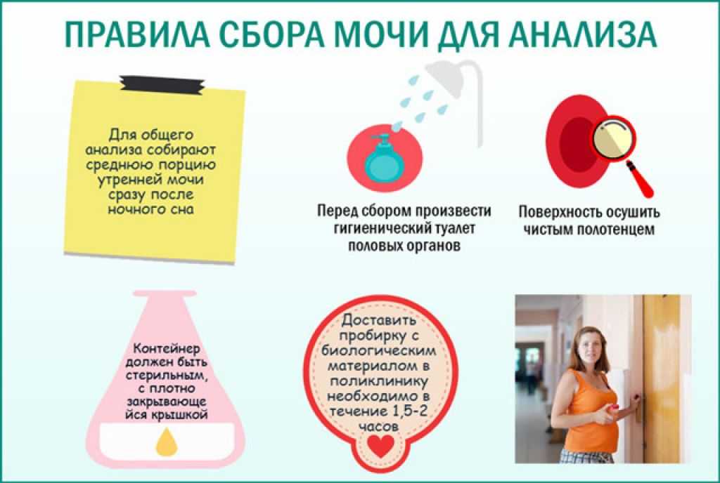 Запах мочи при беременности | уроки для мам