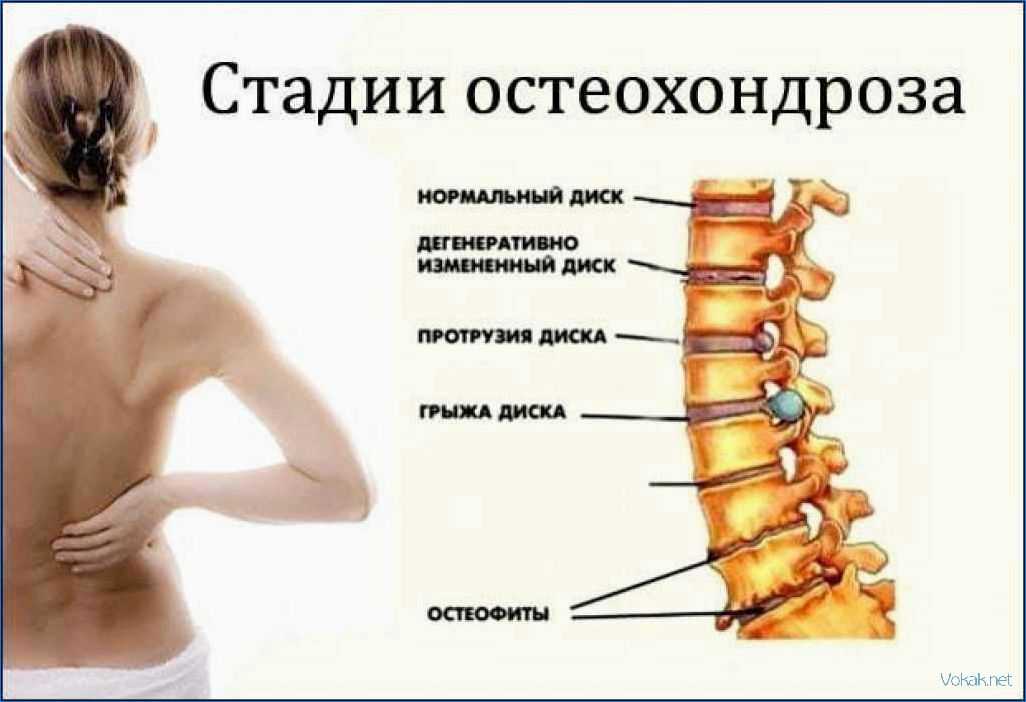 Можно ли пить найз при гриппе