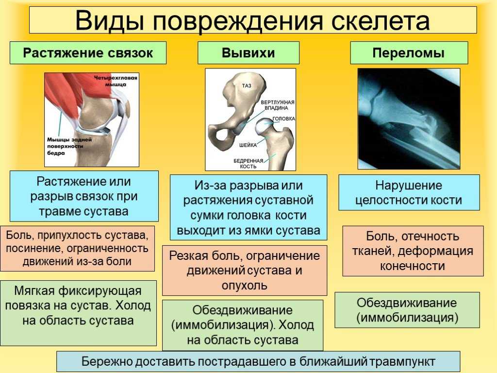 Как различить вывих и ушиб голеностопа? простые советы и признаки