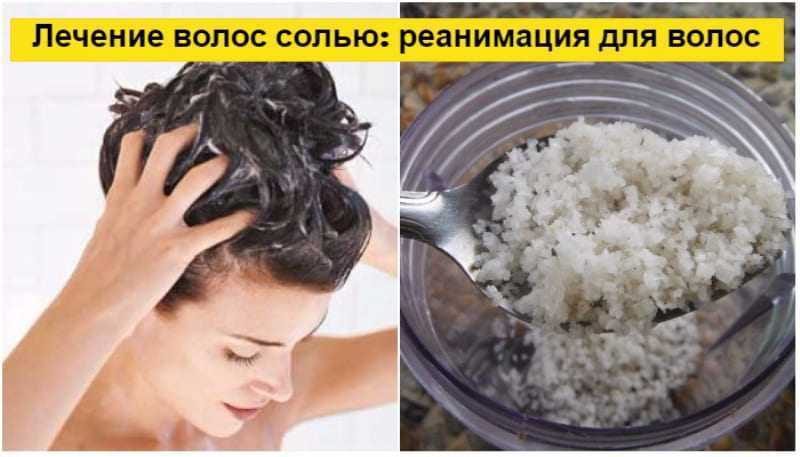 Болит кожа головы: почему и что делать