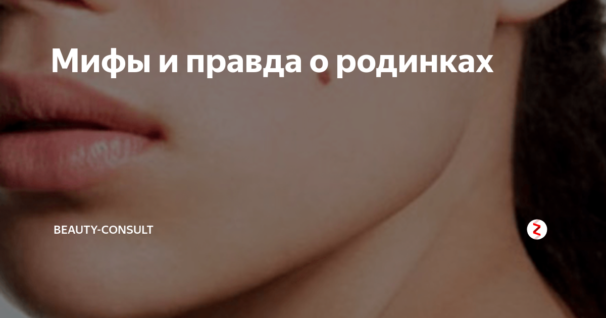 Родинки: опасные и неопасные, фото и описание, удаление, почему появляются