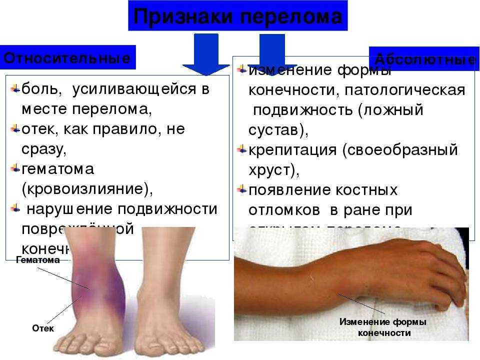 Ушиб запястья