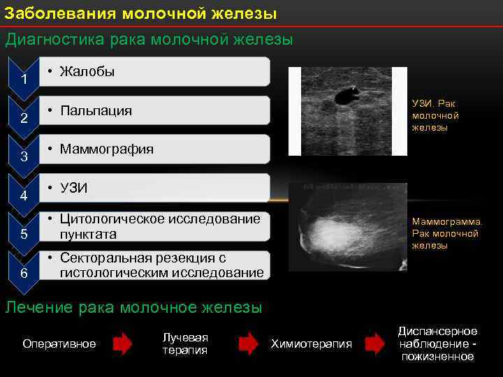 Отличие маммографии от узи молочных желез