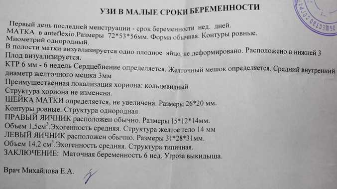 Как распознать выкидыш