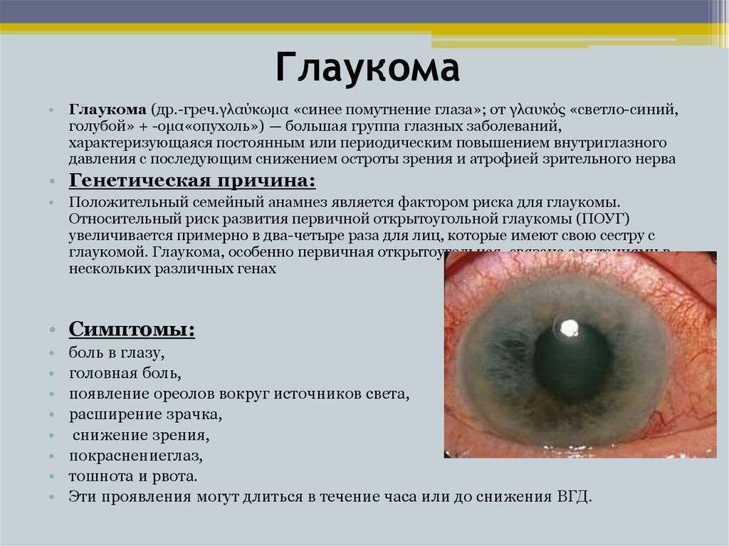 Как не потерять зрение: профилактика глаукомы