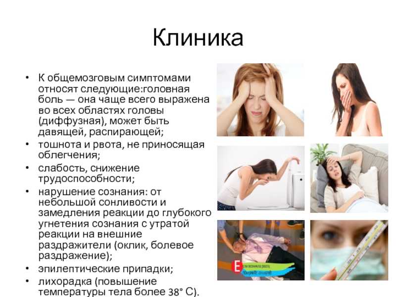 Головная боль, головокружение и тошнота: виды, причины, методы диагностики и лечения | ким