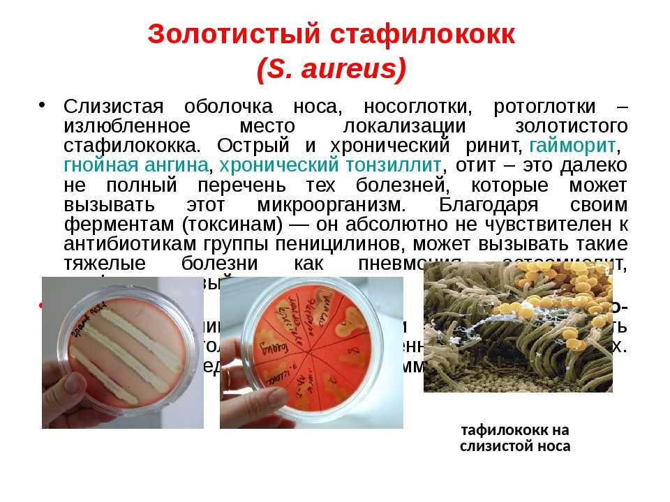 Чем опасен золотистый стафилококк?