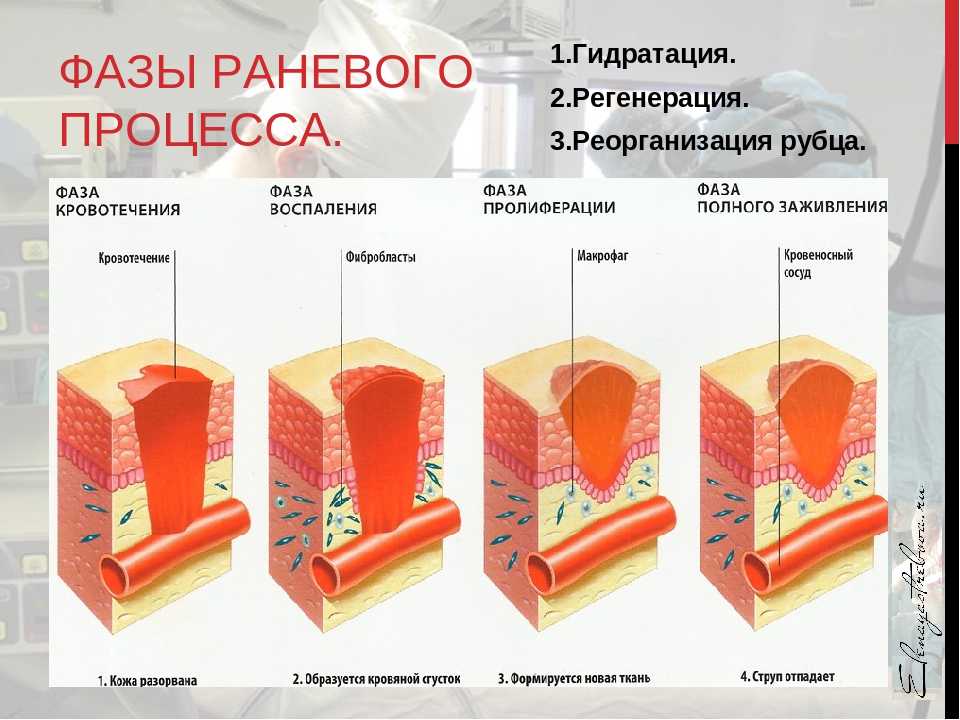 Удаление рубцов и шрамов: коррекция и заживление кожного покрова
