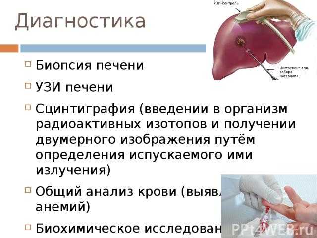 Биопсия печени: как проходит и как к ней готовиться