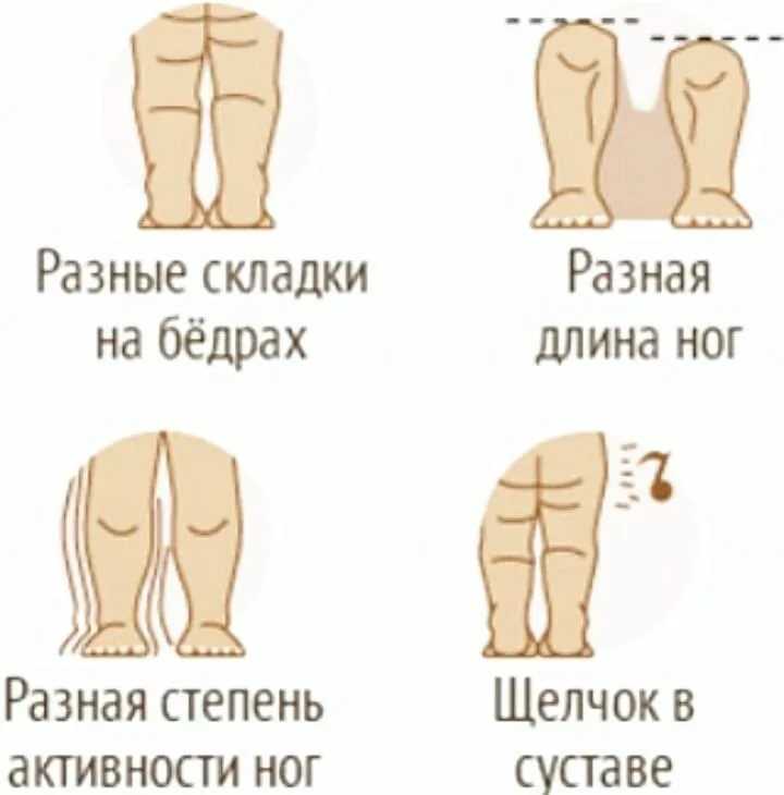 Почему хрустят суставы у детей и подростков: диагностика и лечение