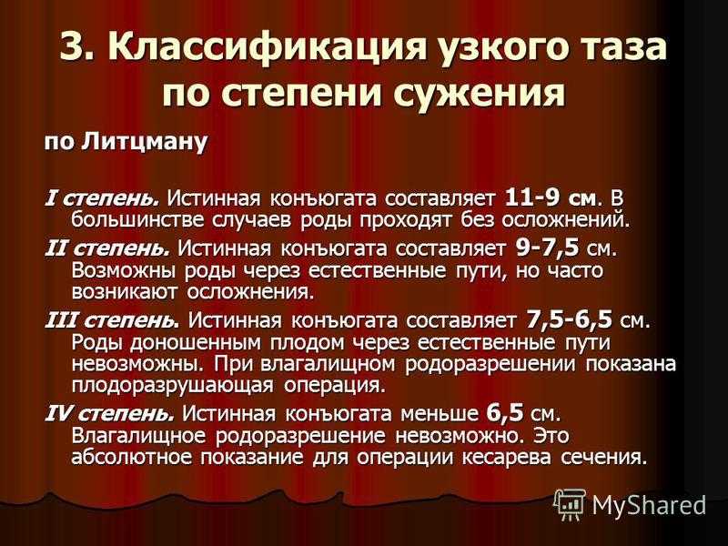Узкий таз: причины, классификация, диагностика