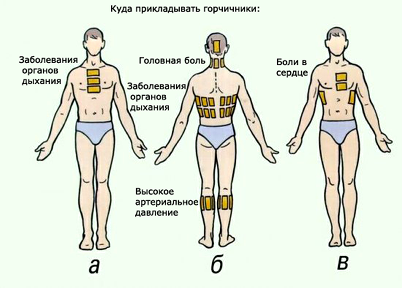 Куда и как ставить горчичники при кашле - инструкция, польза горчичников