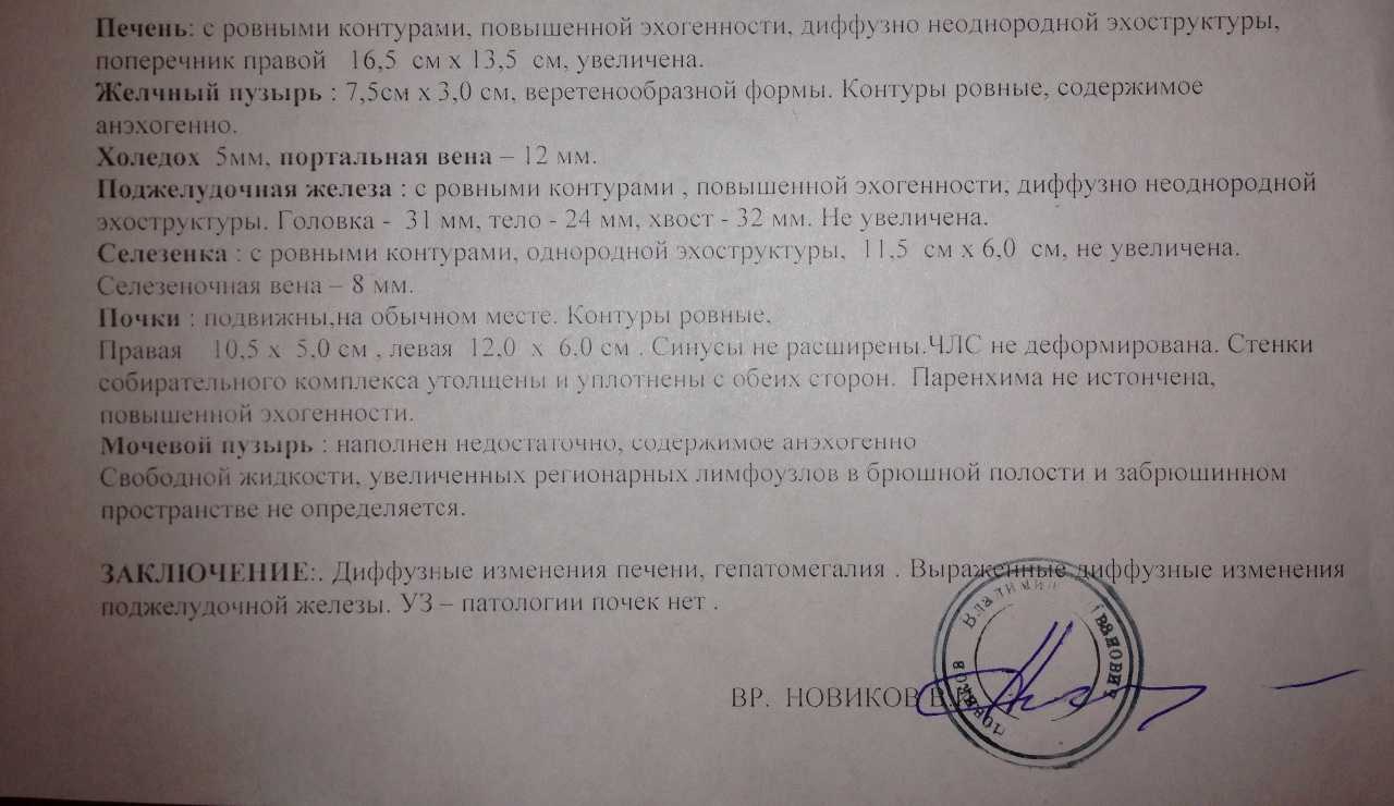 Повышенная эхогенность поджелудочной железы