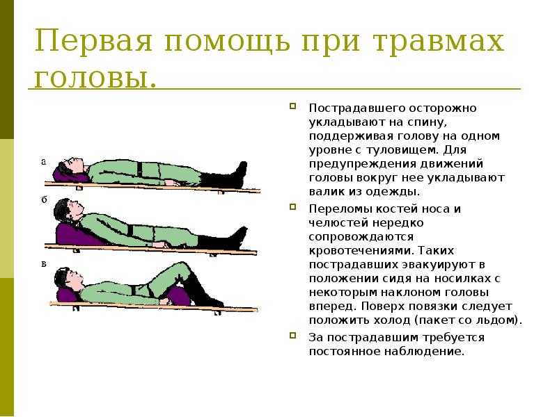 Сотрясение мозга: опасность травмы, признаки и особенности лечения