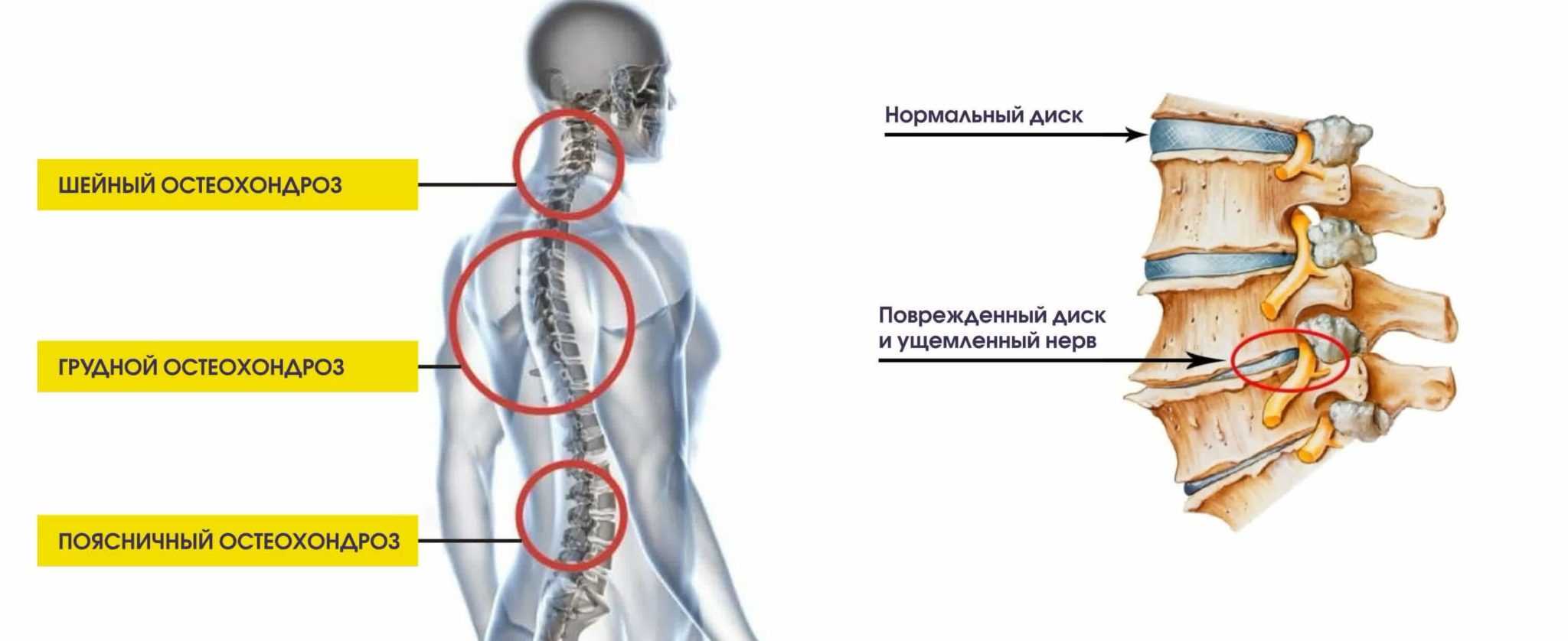 Найз таблетки: инструкция, от чего, сколько действует | журнал "фармацевт практик"