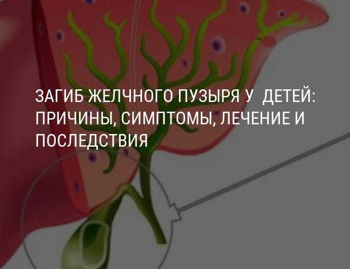 Перетяжка желчного пузыря: симптомы и лечение