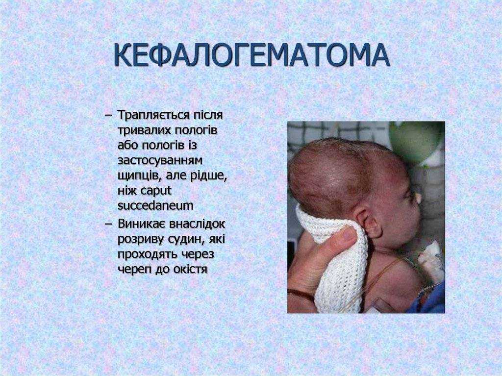 Гематома у новорожденных на голове: фото, последствия, лечение