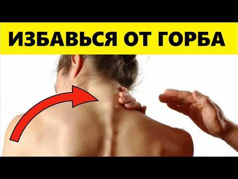 Отложение солей в шейном отделе: как убрать, симптомы скопления