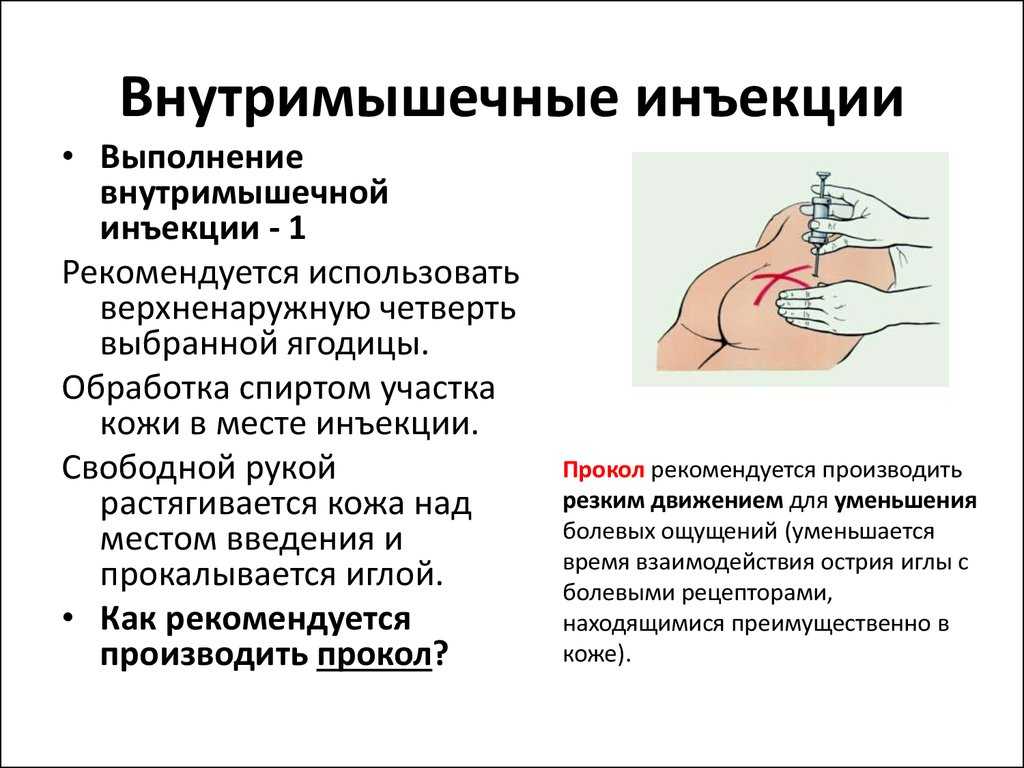 Подкожная инъекция: техника выполнения
