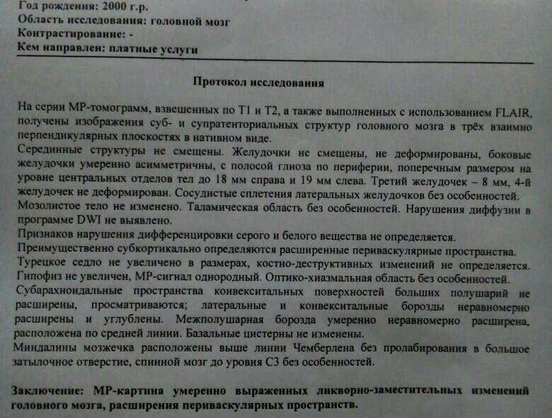 Доброкачественные расширения субарахноидальных пространств